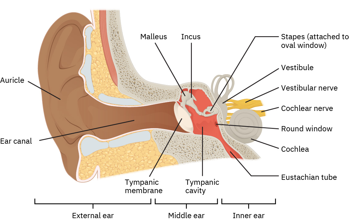 The picture shows the anatomy of a human ear. All organs in the ear are labeled. There is a pinna or the outer end of the ear, followed by a long ear canal in the outer ear. The middle ear has the eardrum little arc shaped. There are small round and oval windows next to it. There are semicircular canals. In the inner ear are snail shell shaped cochlea and cochlea duct. There is a Eustachian tube that leads downward. There are cochlear nerve and vestibular nerves in the inner ear.