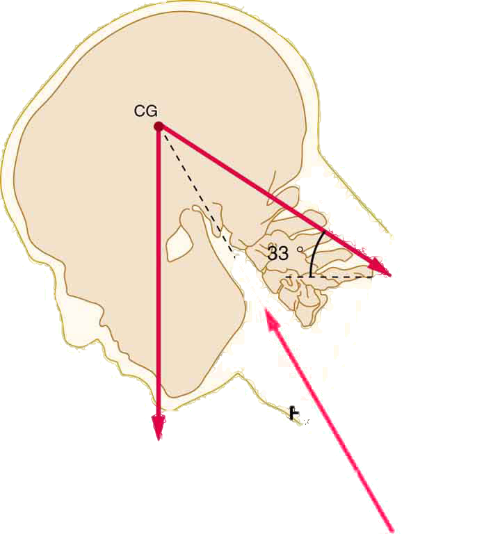 The head of a person working at a drafting board in relaxed position is shown. The inclination of the head is theta to the horizontal and the center of gravity is near the top of the head. The weight of the head is fifty newtons and is acting downward at the center of gravity. Three major forces are shown. The force exerted along the neck is sixty newtons.