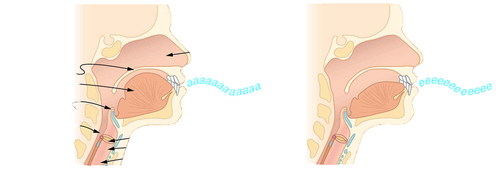 Two pictures of the throat and mouth in cross-section are shown. The first picture has parts of the mouth and throat labeled. The first picture shows the position of the mouth and tongue when producing an a a a sound, and the second picture shows the position of the mouth and tongue when producing an e e e sound.