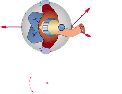 An overhead view of a child sitting on a snow saucer sled. Two forces, F sub one equal to ten newtons and F sub two equal to eight newtons, are acting toward the right. F sub one makes an angle of forty-five degrees from the x axis and F sub two makes an angle of thirty degrees from the x axis in a clockwise direction. A friction force f is equal to seven point five newtons, shown by a vector pointing in negative x direction. In the free-body diagram, F sub one and F sub two are shown by arrows toward the right, making a forty-five degree angle above the horizontal and a thirty-degree angle below the horizontal respectively. The friction force f is shown by an arrow along the negative x axis.