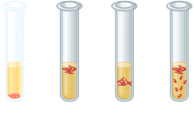 A) Cells are all at the bottom of the tube. b) Cells are all at the top of the tube. C) Cells are all just under the top of the tube. D) Cells are throughout the tube but more prominent at the top.